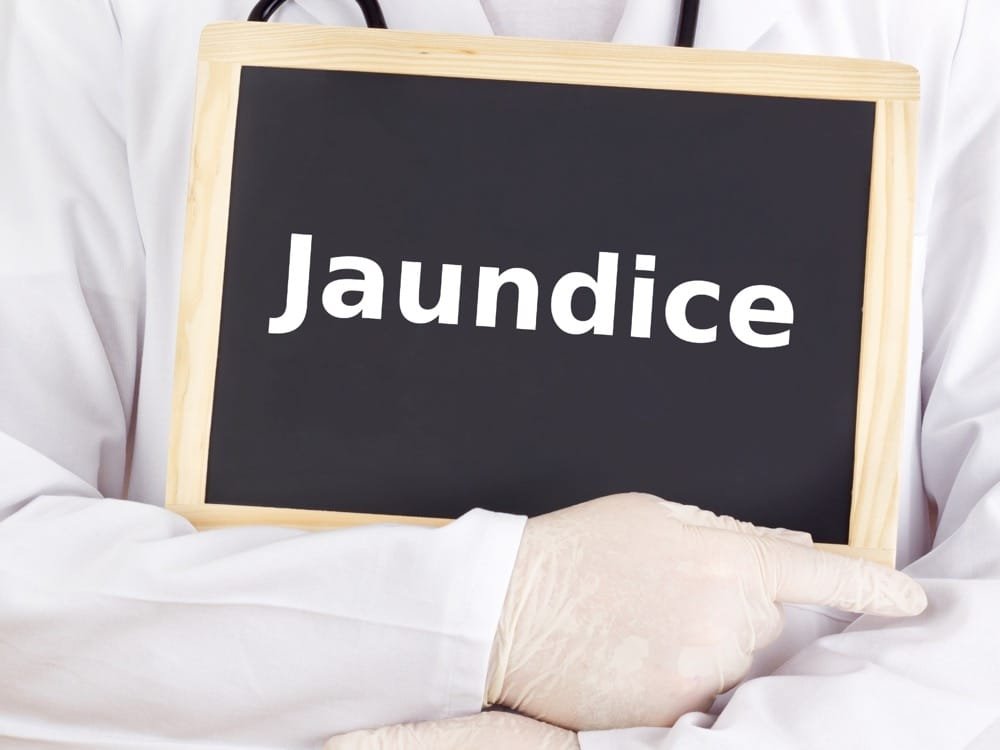 Jaundice: Causes, Symptoms and Treatments